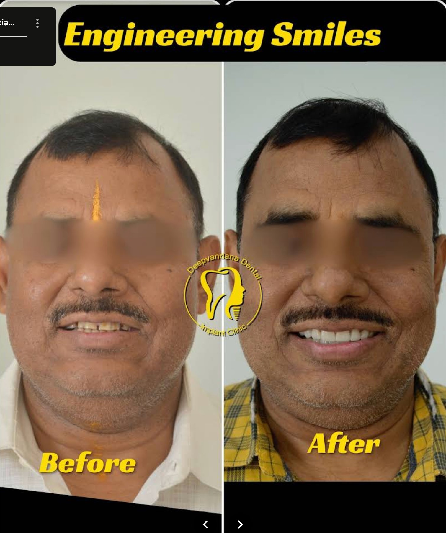 Smile transformations